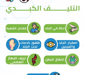 اعراض التليف الكبدى