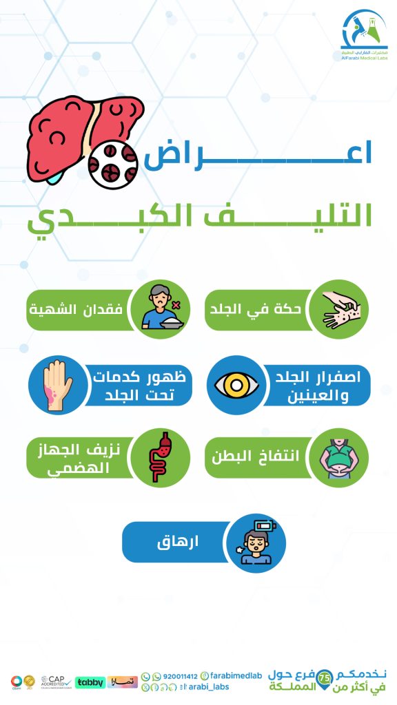 اعراض التليف الكبدى
